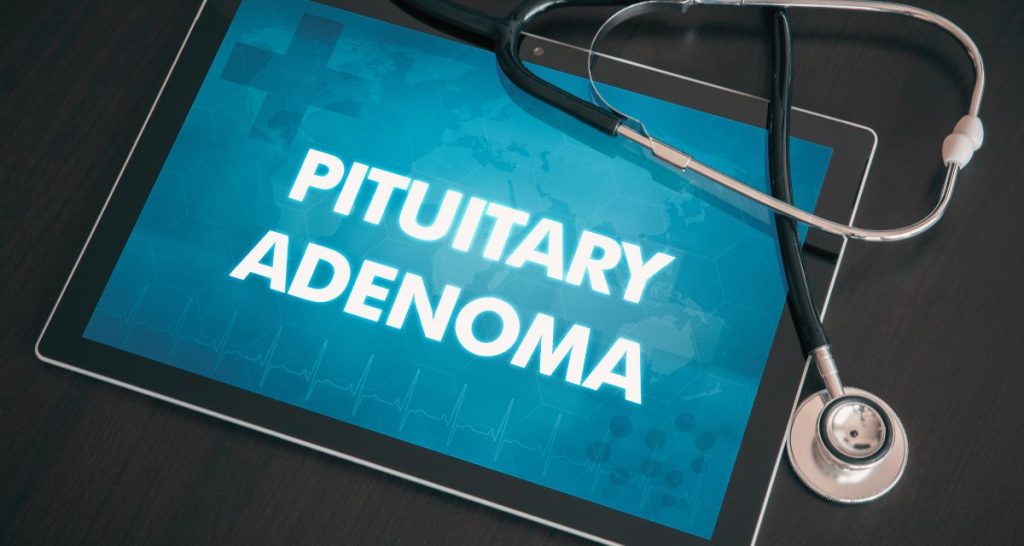 What Causes Acromegaly
