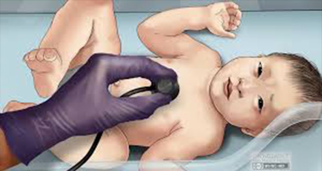 Acute Respiratory Distress Syndrome