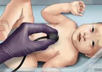 Acute Respiratory Distress Syndrome