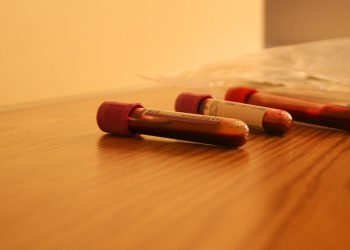 Amniocentesis Results and What They Mean