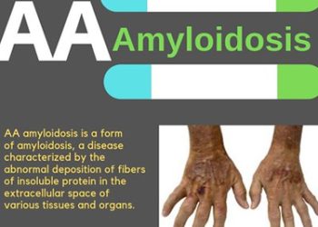 Amyloidosis