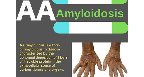Amyloidosis