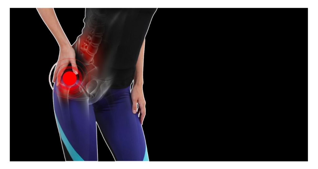 Anal Fistula