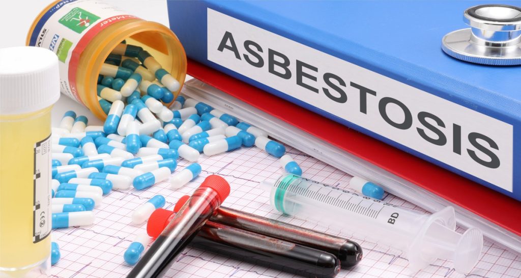 Asbestosis