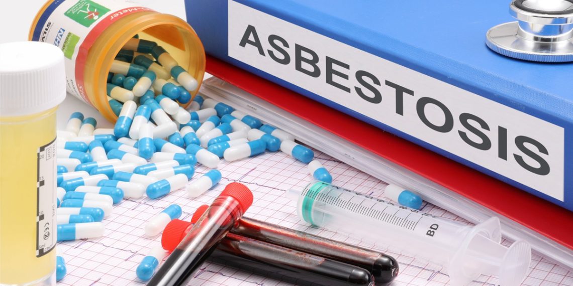 Asbestosis