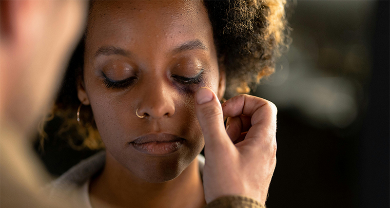 Woman with a black eye being gently examined by another person, suggesting concern and emotional support.