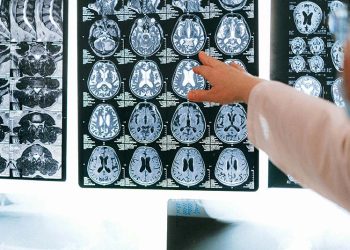 Doctor reviewing brain scan MRI images for signs of brain death