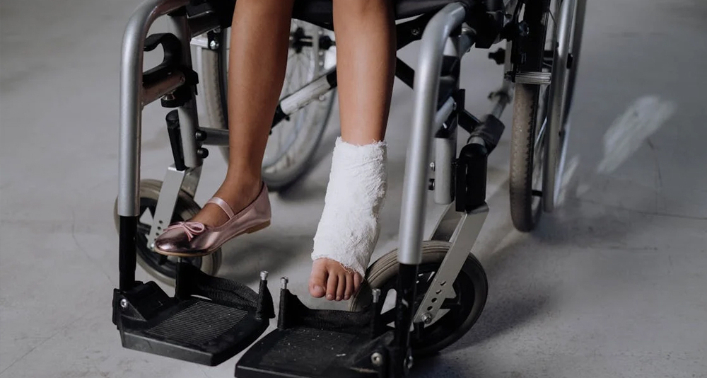 Child in wheelchair with leg cast
