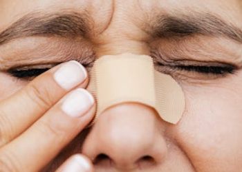 Woman touching nose with plaster bandage – broken nose pain