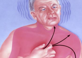 Illustration of a man clutching his chest with directional arrows indicating heart signal disturbance