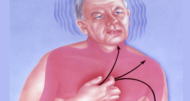 Illustration of a man clutching his chest with directional arrows indicating heart signal disturbance
