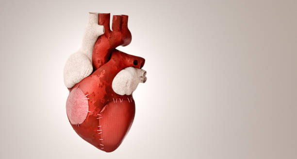 Model of a stitched human heart symbolising cardiovascular disease