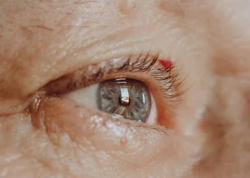 Close-up of an elderly person's eye with visible cataract signs