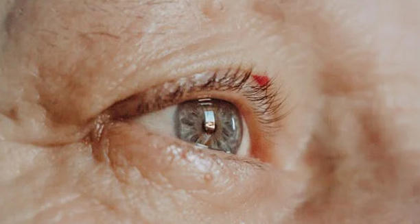 Close-up of an elderly person's eye with visible cataract signs