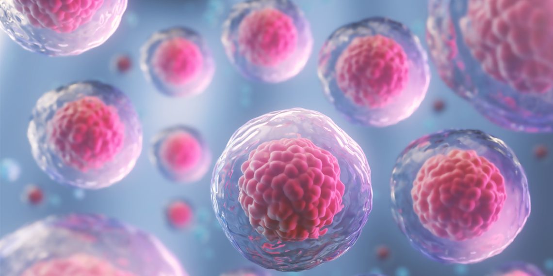 Microscopic view of human cells representing genetic and cellular basis of ARPKD.