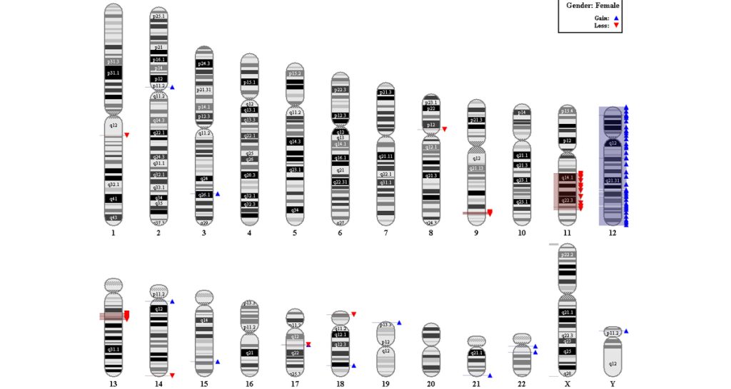Causes and Genetics of Angelman Syndrome