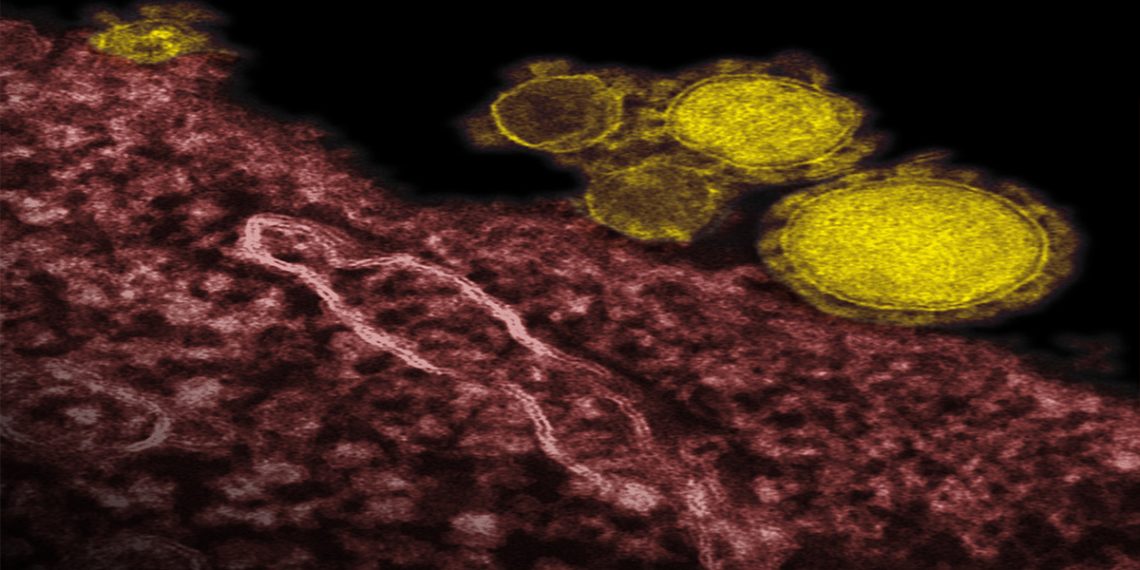 Causes and Risk Factors of ARDS