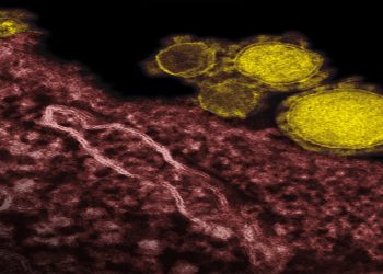 Causes and Risk Factors of ARDS