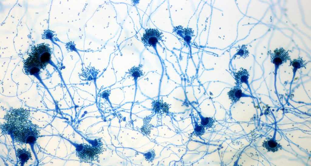 Causes and Risk Factors of Aspergillosis