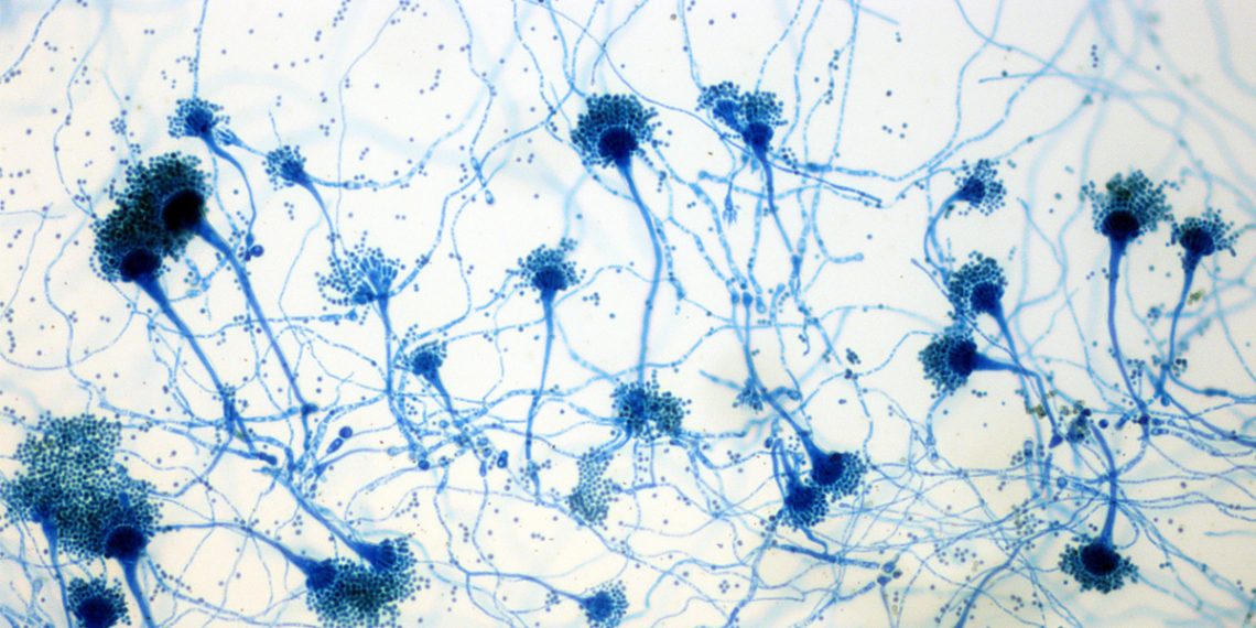 Causes and Risk Factors of Aspergillosis