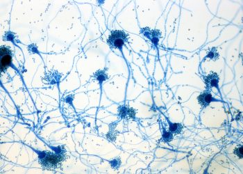 Causes and Risk Factors of Aspergillosis