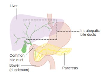 Causes and Risk Factors of Cholangiocarcinoma