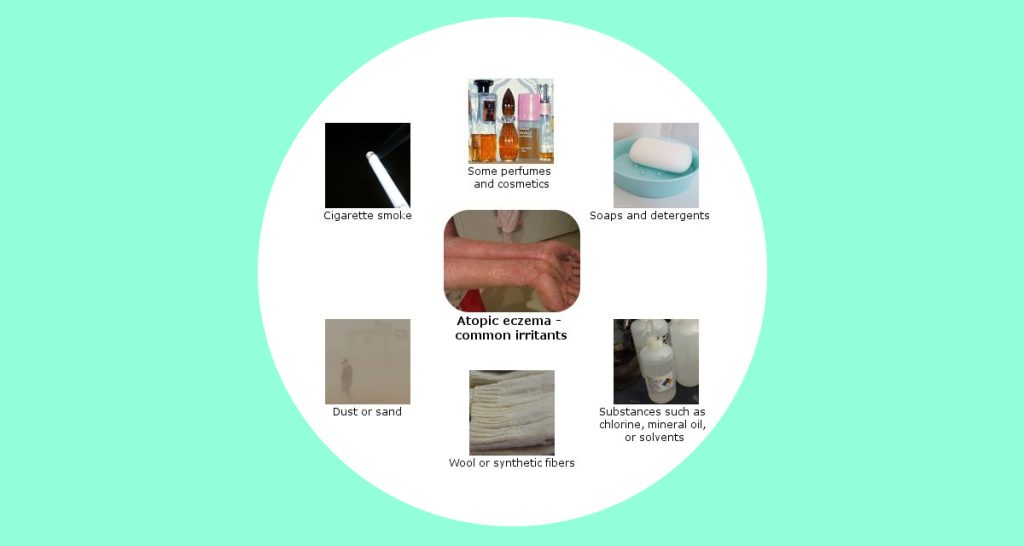 Causes and Triggers of Atopic Eczema