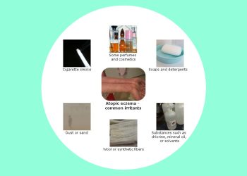 Causes and Triggers of Atopic Eczema
