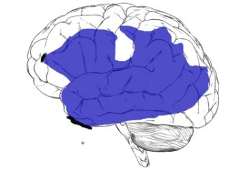 Causes and Types of Aphasia