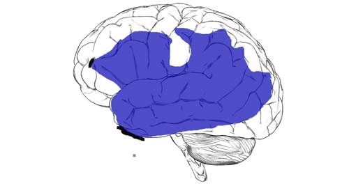 Causes and Types of Aphasia