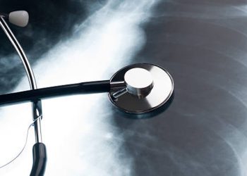 Causes of Bronchiectasis