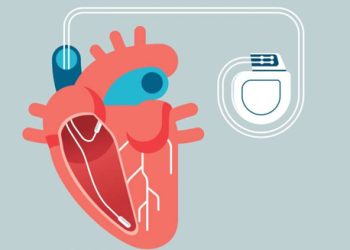Medical illustration of heart with pacemaker showing electrical pathway