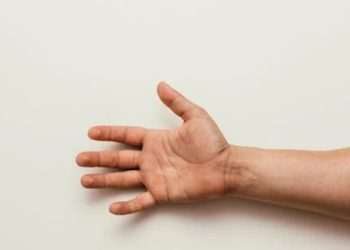 Outstretched hand showing palm and wrist