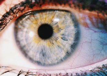 Close-up of human eye showing potential cataract development