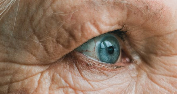 Close-up of an elderly person's eye with visible signs of cataract