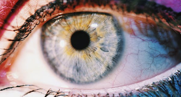 Close-up of human eye showing potential cataract development