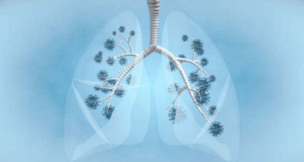3D illustration of lungs infected with pathogens