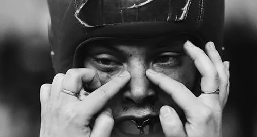 Boxer pressing bruised nose after injury – causes of a broken nose