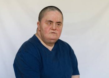 Man with visual impairment sitting against a plain backdrop