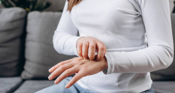 Woman scratching her irritated hand while sitting on a couch