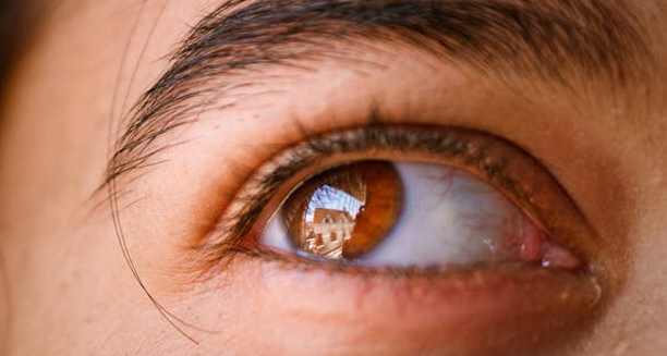 Close-up of a child’s eye showing signs of cataracts