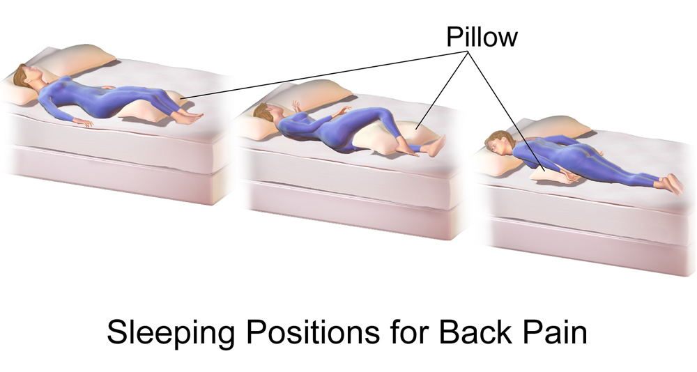 Illustration showing ideal sleeping positions for back pain relief using pillows