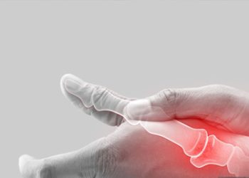 Digital illustration of a broken thumb joint with pain highlighted