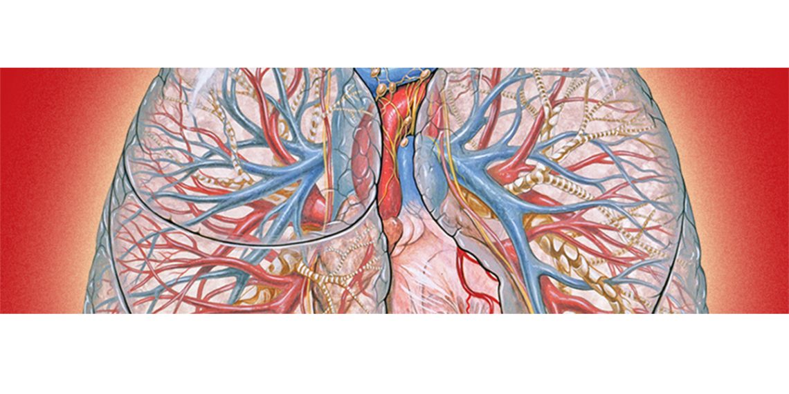 Complications and Recovery of ARDS