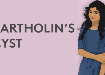 Illustration of a woman with text "Bartholin’s Cyst" representing awareness and education about cyst complications.