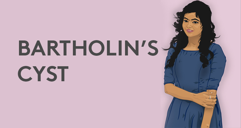 Illustration of a woman with text "Bartholin’s Cyst" representing awareness and education about cyst complications.