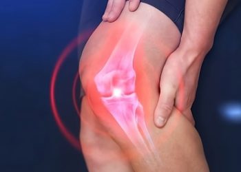 Complications of Alkaptonuria