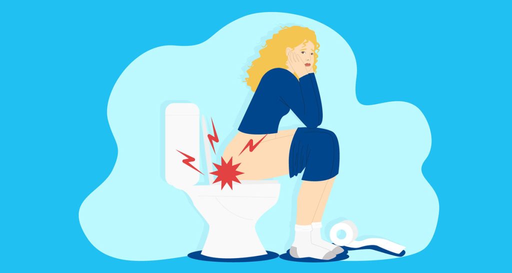 Complications of Anal Fissure