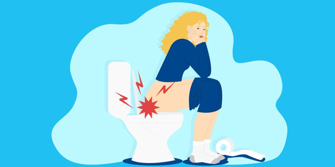 Complications of Anal Fissure