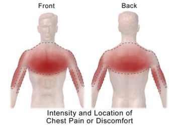 Complications of Atherosclerosis